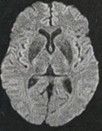 Mon cerveau.